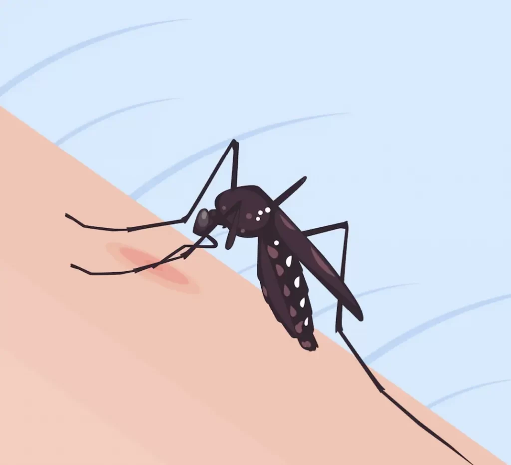 sivrisinek isiriği kaşintisi nasil geçer 1